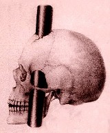 phineas gage